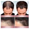 3Pcs Zephta H-Regrow 2.0, Zephta Hair Regrowth, Prorevita Rice Nutri Spray, for Hair