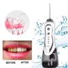 Household Ipx7 300ml Floss Usb Home Powerful Travel Teeth Cleaner Cordless Electric Portable Oral Irrigator Dental Water Flosser