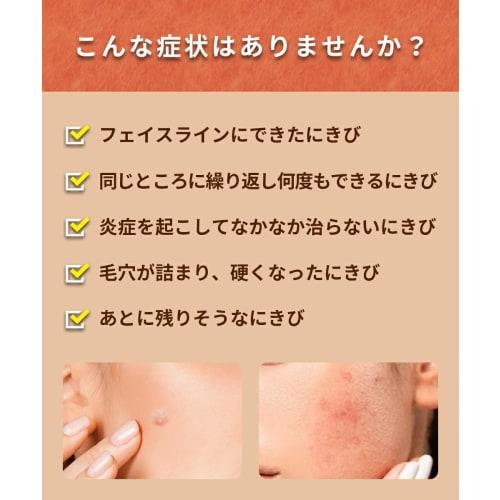 [Category 2 OTC drug] Lauma Acne Cream 18g