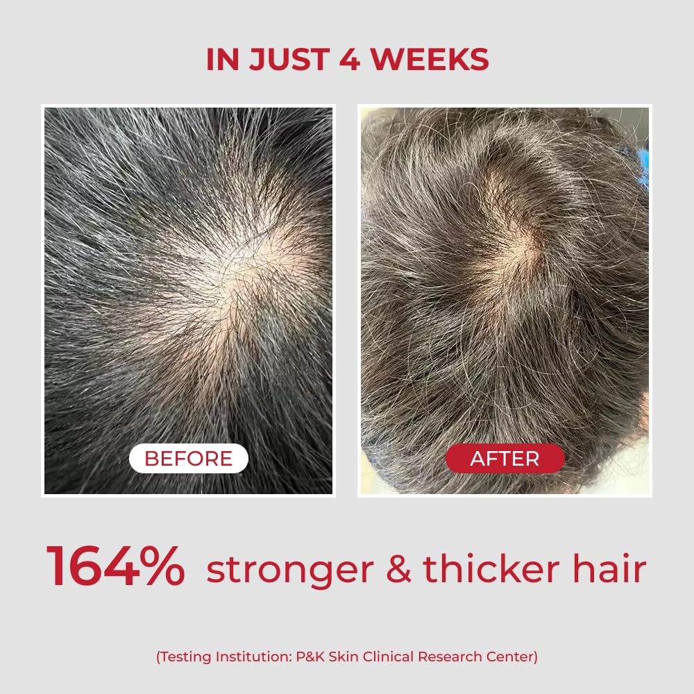 moev ANNURCATIN Shampoo Korean Apple Hair Care for Strength and Volume In Thinning Hair