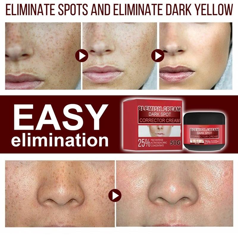 Whitening and Brightening Blemish Cream, Purifying, Brightening and Diminishing Spots, Universal for Men and Women