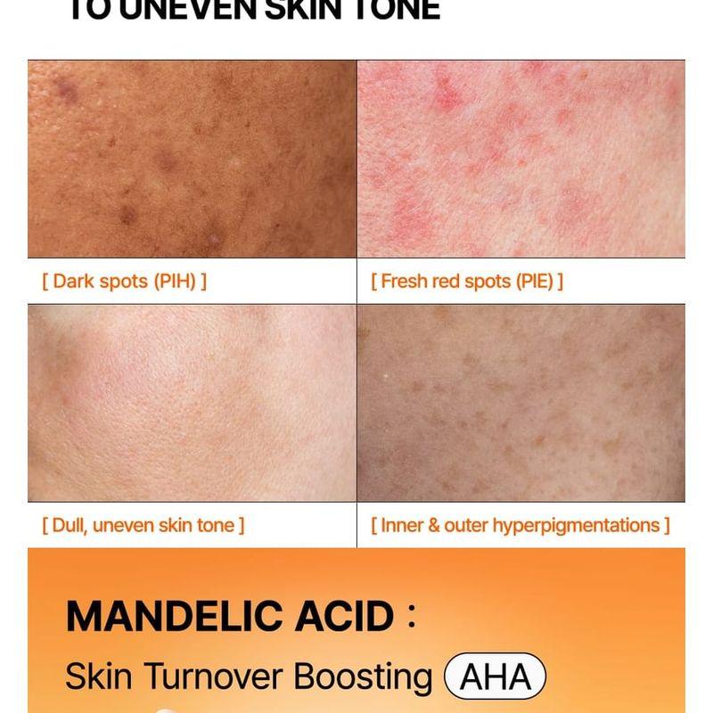 By Wishtrend Mandelic Acid Dark Spot Correcting Serum