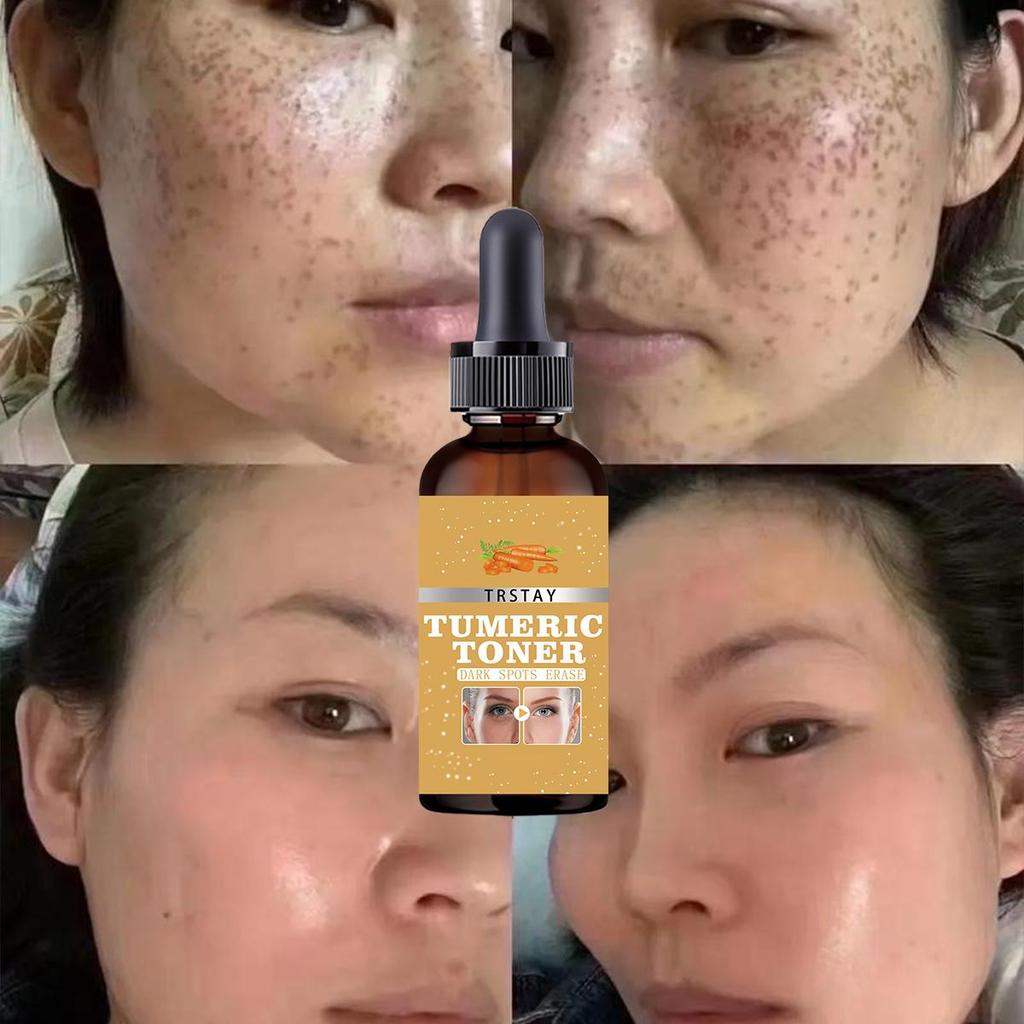 Turmeric Oil Deep Moisture Serums Brighten Fade Dark Spot Removal Pigment Melanin Correcting Beauty Face Skin Care