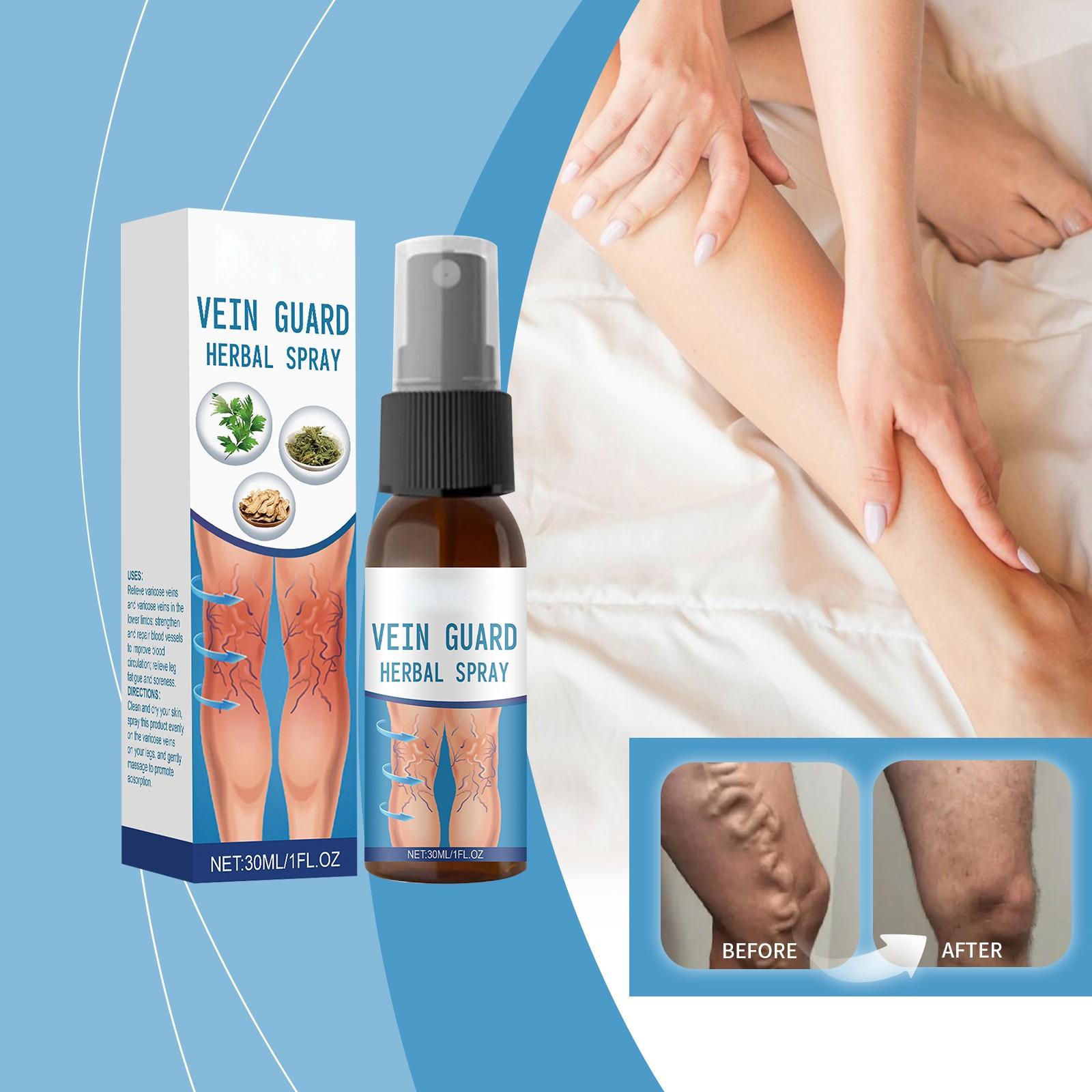 Varices Care Spray Care Massage Blue Veins Red Blood Silk Varices Massage,30ml, One Size