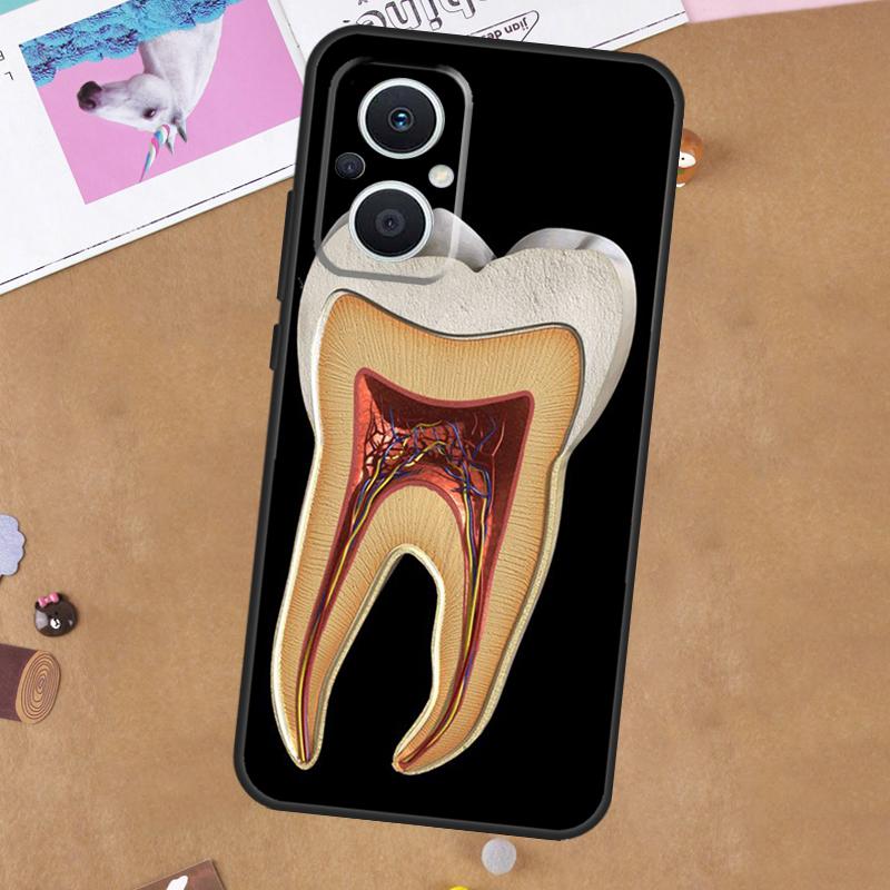 Human Tooth Anatomy Case For OPPO Reno 11 10 Pro 8 7 6 5 4 Lite 8T 5Z 4Z 11F OPPO Find X5 X6 Pro X2 Neo X3 Lite