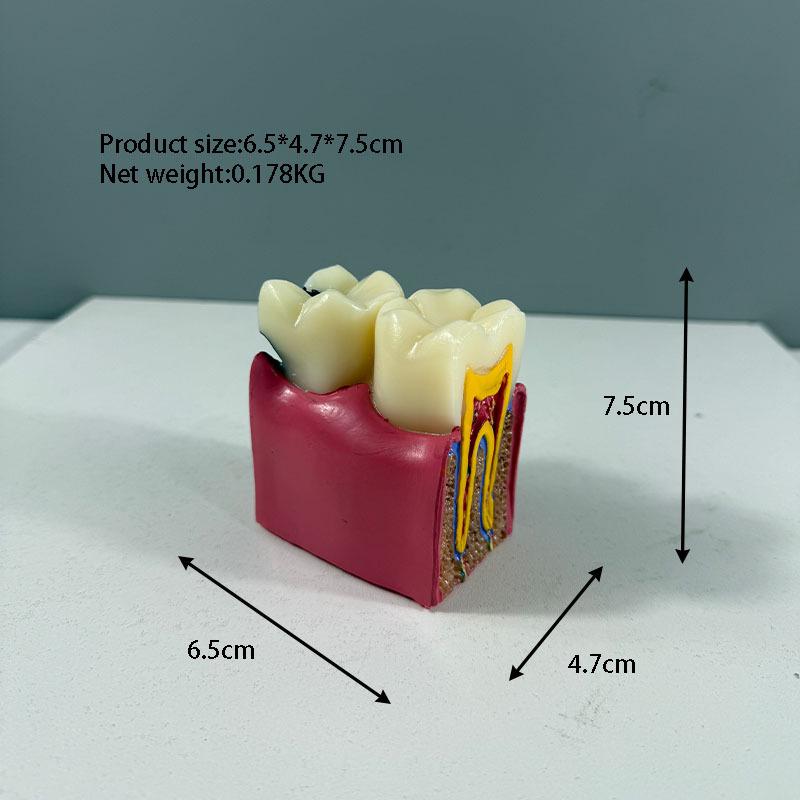 Прозора Знімна Повна Модель Щелепи з М'якими Яснами та Зубами для Підготовки до Імплантації
