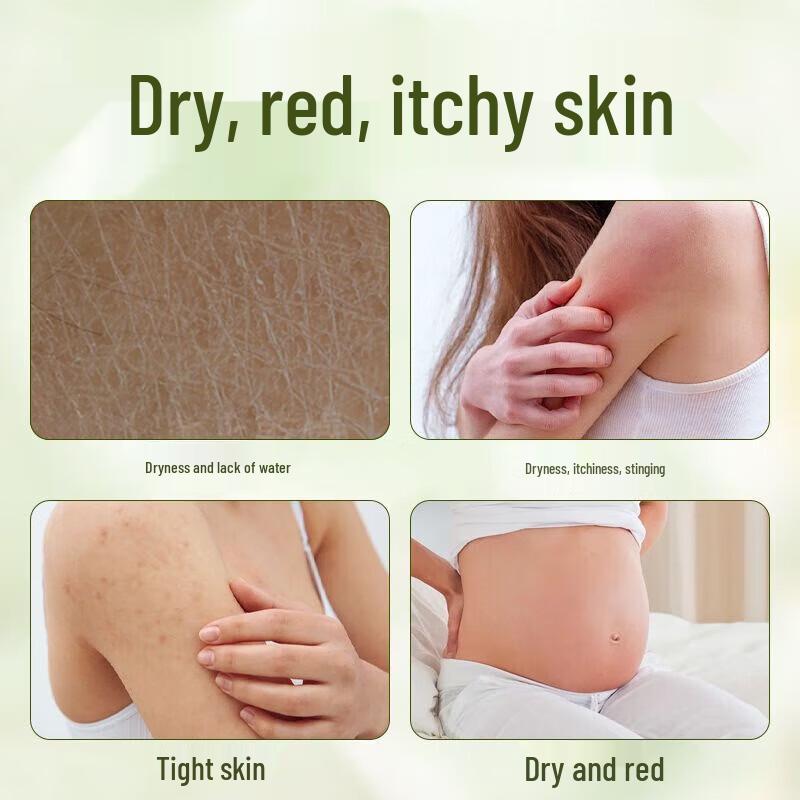 Renhe Jingxin Juckreizlindernde Feuchtigkeitsspendende Körperlotion