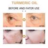 1/2/3/5pcs 30ml Turmeric Freckle Whitening Serum Curcumin Pigment Brighten Correcting Oil Spot B5C0