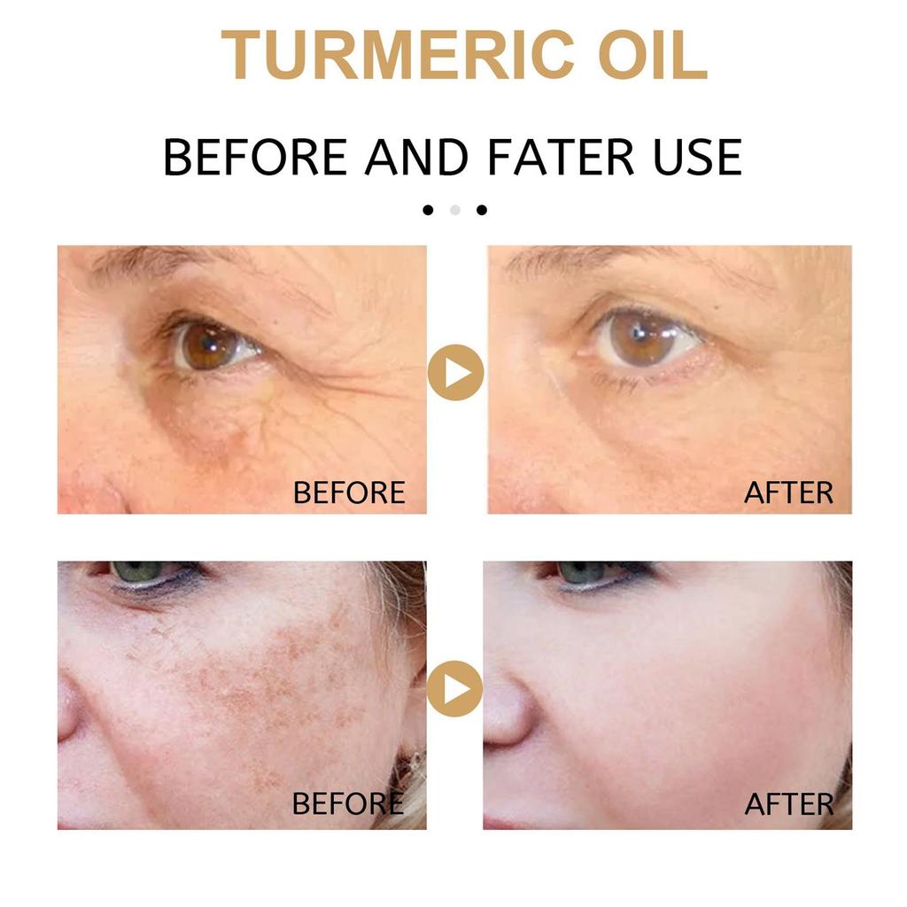 1/2/3/5pcs 30ml Turmeric Freckle Whitening Serum Curcumin Pigment Brighten Correcting Oil Spot B5C0