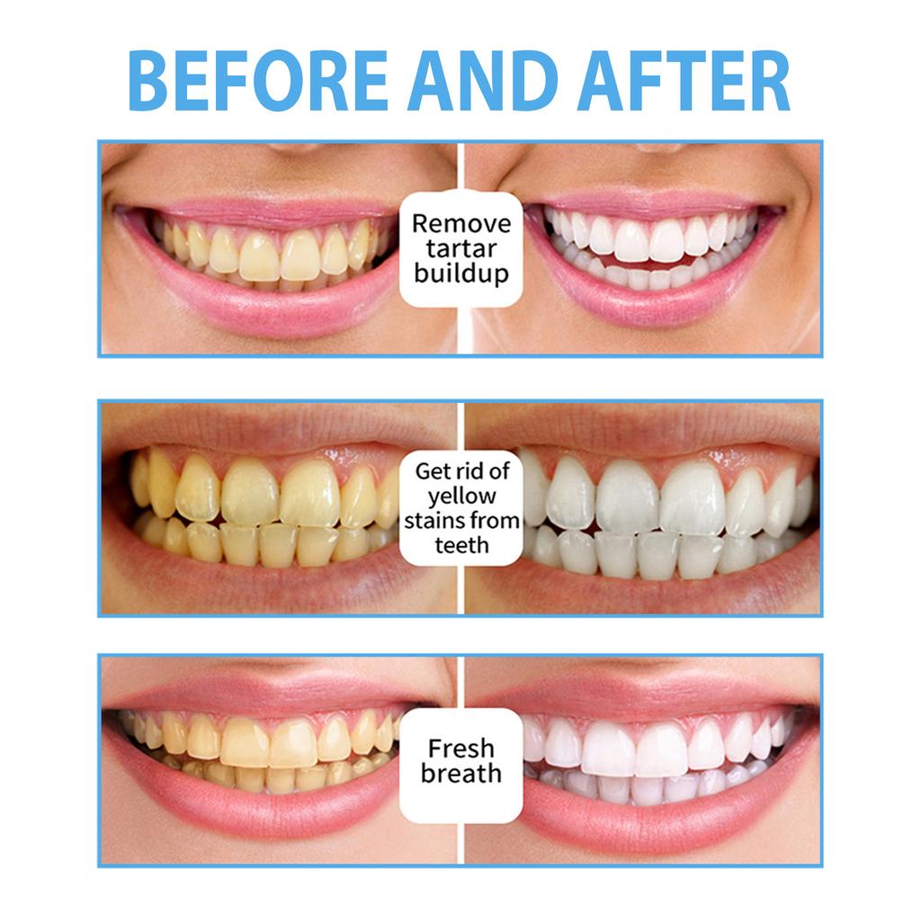 EELHOE Mousse Toothpaste Teeth Whitening Mousse Deep Cleaning Foam Toothpaste Removes Stains Fresh Breath Dental Care Tools 60ml