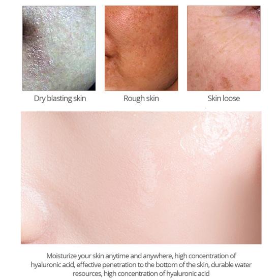 30ml Kyselina hyaluronová Pleťový krém Zpevňující pleť Zlepšuje elasticitu Přírodní extrakt Proti stárnutí Stahuje póry Krém proti vráskám pro ženy