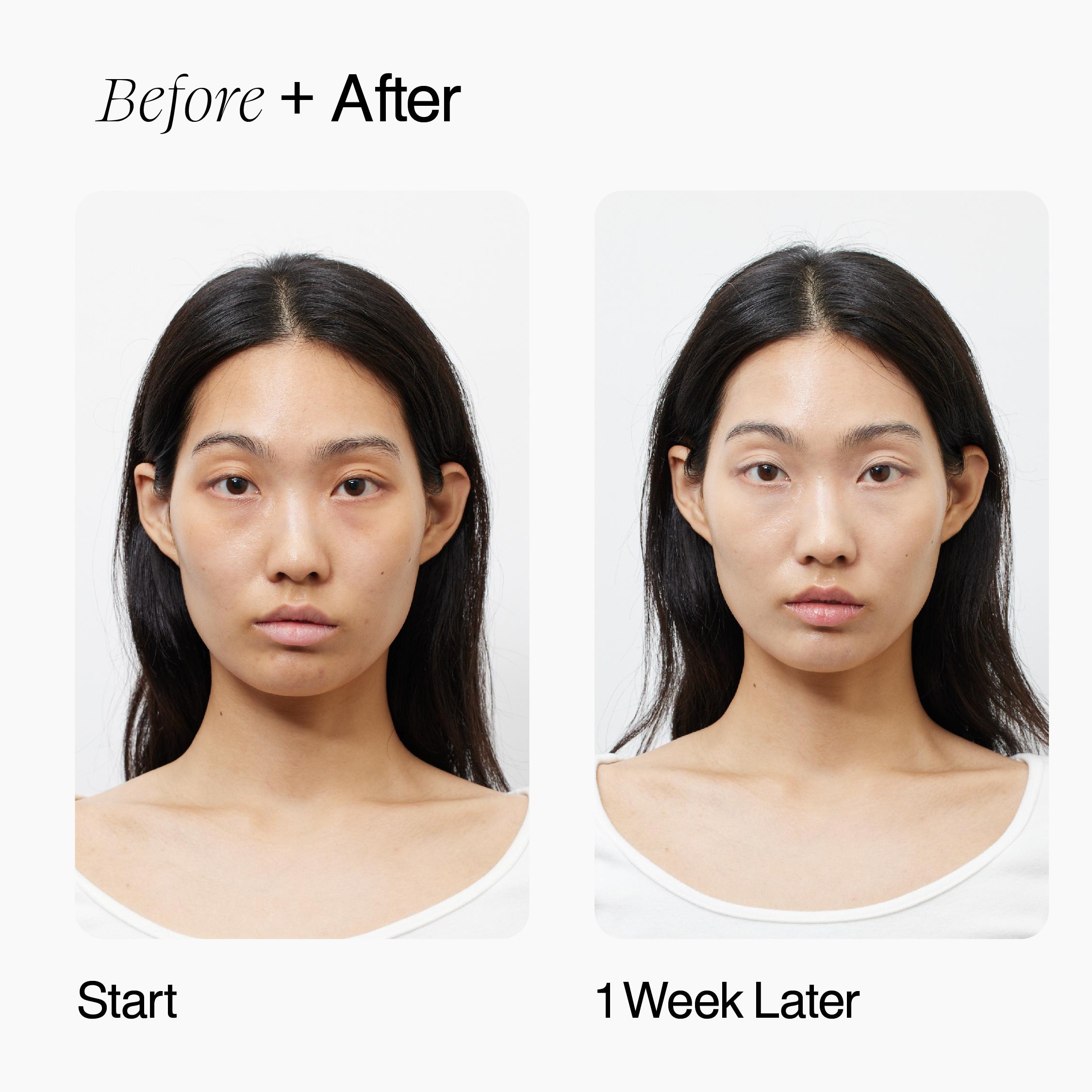 [NURICLE] 9 PEPTIDES MYCO Boosting Dose 30 мл — фото 10