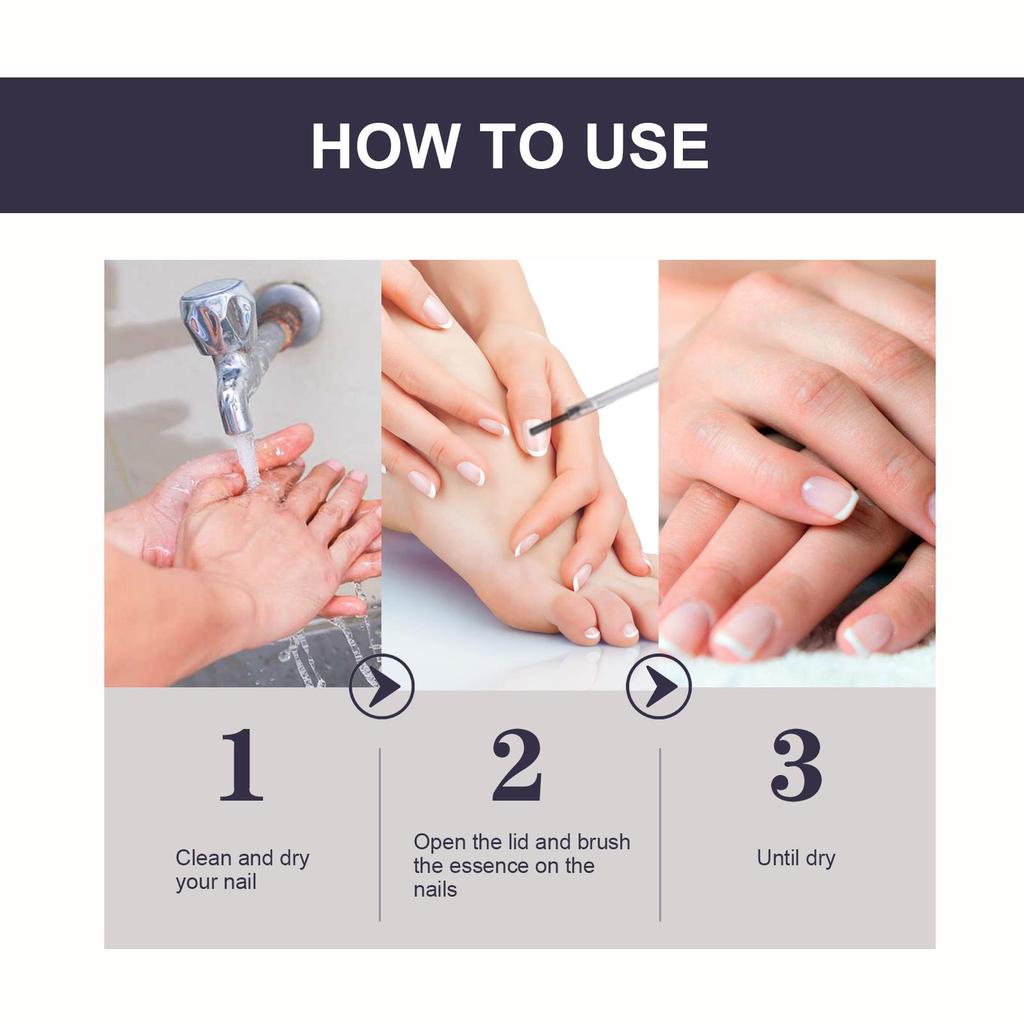 OUHOE Nail Repair Essence Soft Nail Thickening Nail Smoothing Endogenous toenail Nail Fungus Repair Essence