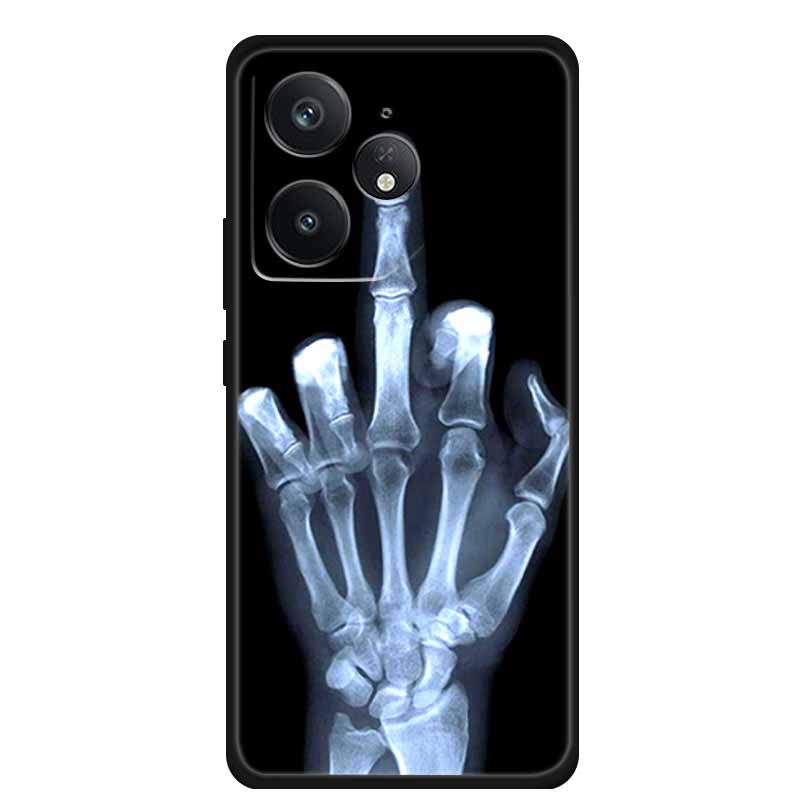 For Realme Neo 7 5G Phone Case Black Silicone Soft Back Cover For Realme Neo7 x Neo 7x Neo7x Neo 7 SE Neo7 SE Case Coque Funda