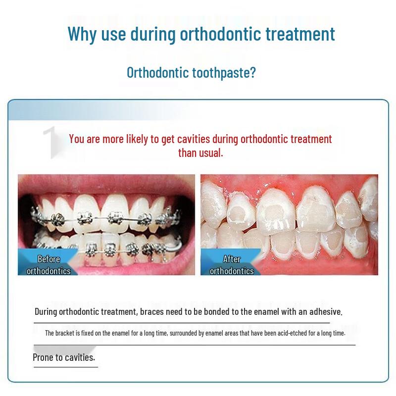 Colgate Pump Zahnpasta Karies-Schutz & Frischer Atem Set