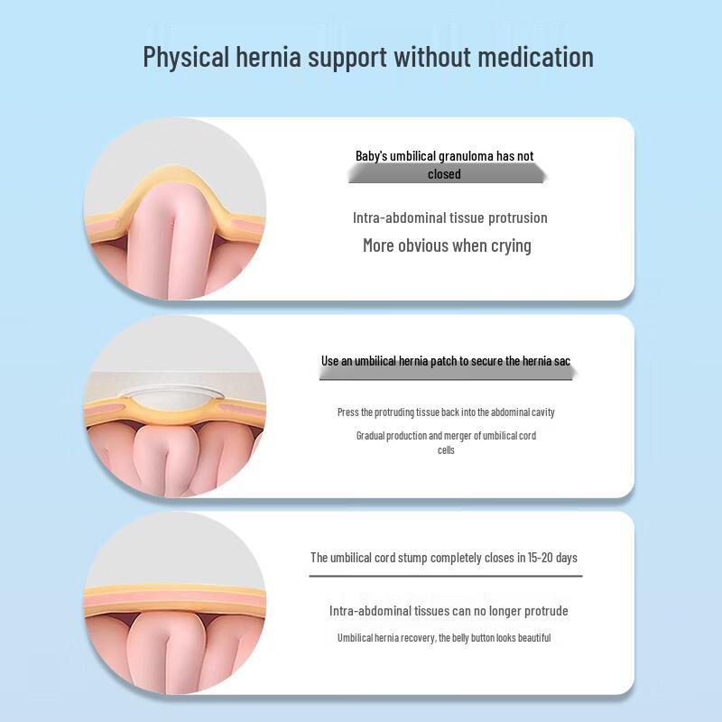 Mybaishi Baby Umbilical Hernia Patch