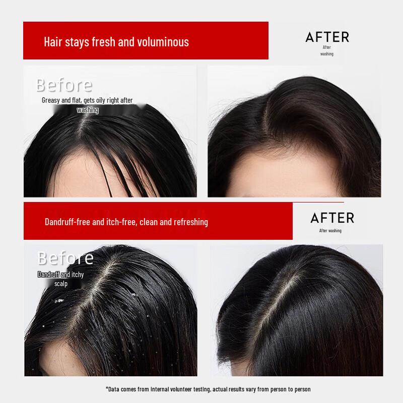 Cai Le Bifida Ferment Scalp Care Shampoo