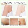 Magnesium Body Butter Cream for Neuropathy Relief 114g Shea Butter Moisturizer for Dry Skin Calming Smoothing Body Cream