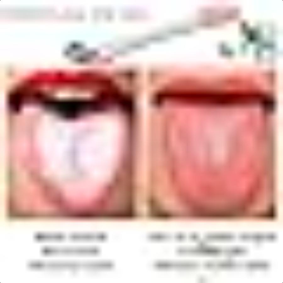 

2 шт. Скребок для языка Очиститель Лечение неприятного запаха изо рта Избавьтесь от белого налета на языке 100% без БФА Розово-зеленый… United States
