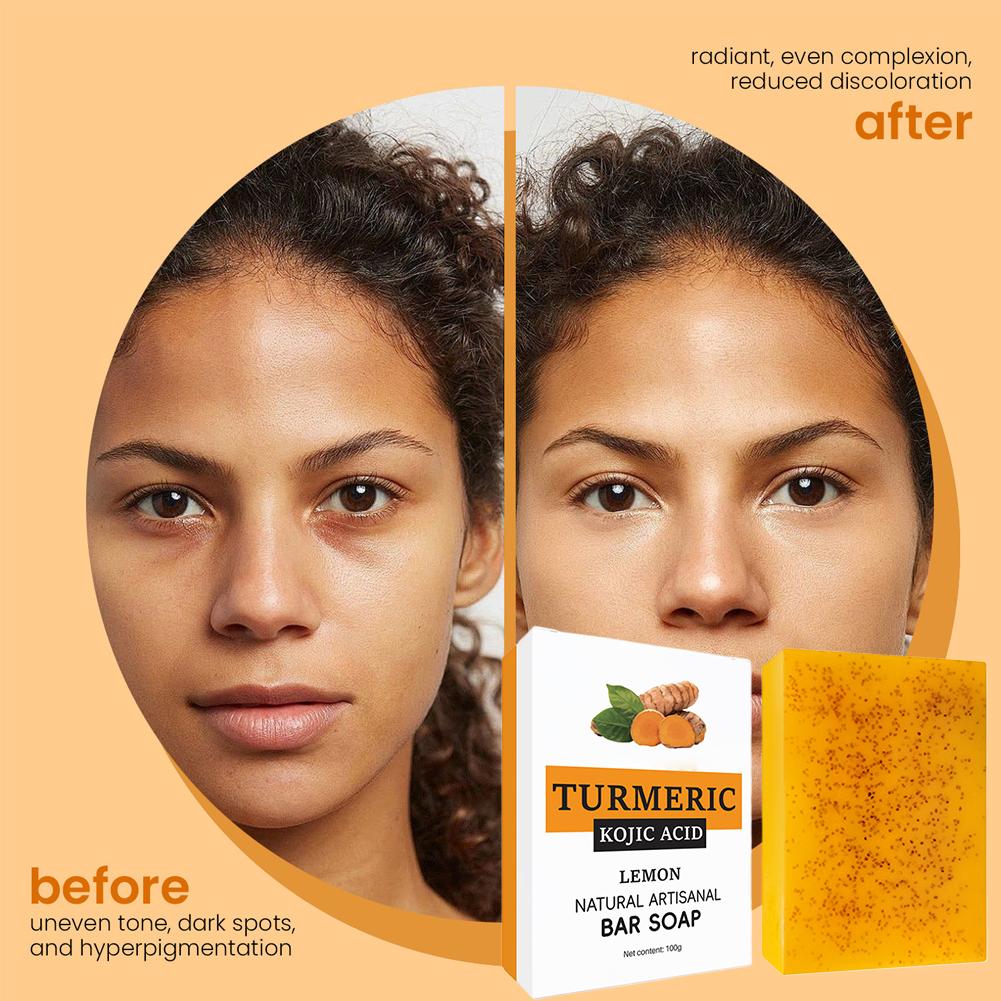 100g Turmeric Kojic Acid Soap For Dark Spot Moisturizing For Face & Body Natural Cleansing Soap For Oily & Dry Care