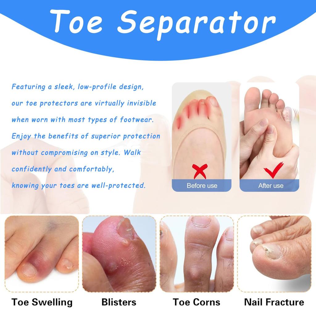 30/60pcs Silicone Finger and Toe Protector, Breathable Waterproof Foam Pad, Suitable For Nail Care, Sports, Outdoor Activities