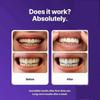 Strisce Sbiancanti Denti Viola Formula Delicata Per Uso Quotidiano Sicuro per lo Smalto Effetto Sbiancante Istantaneo Per Denti Sensibili