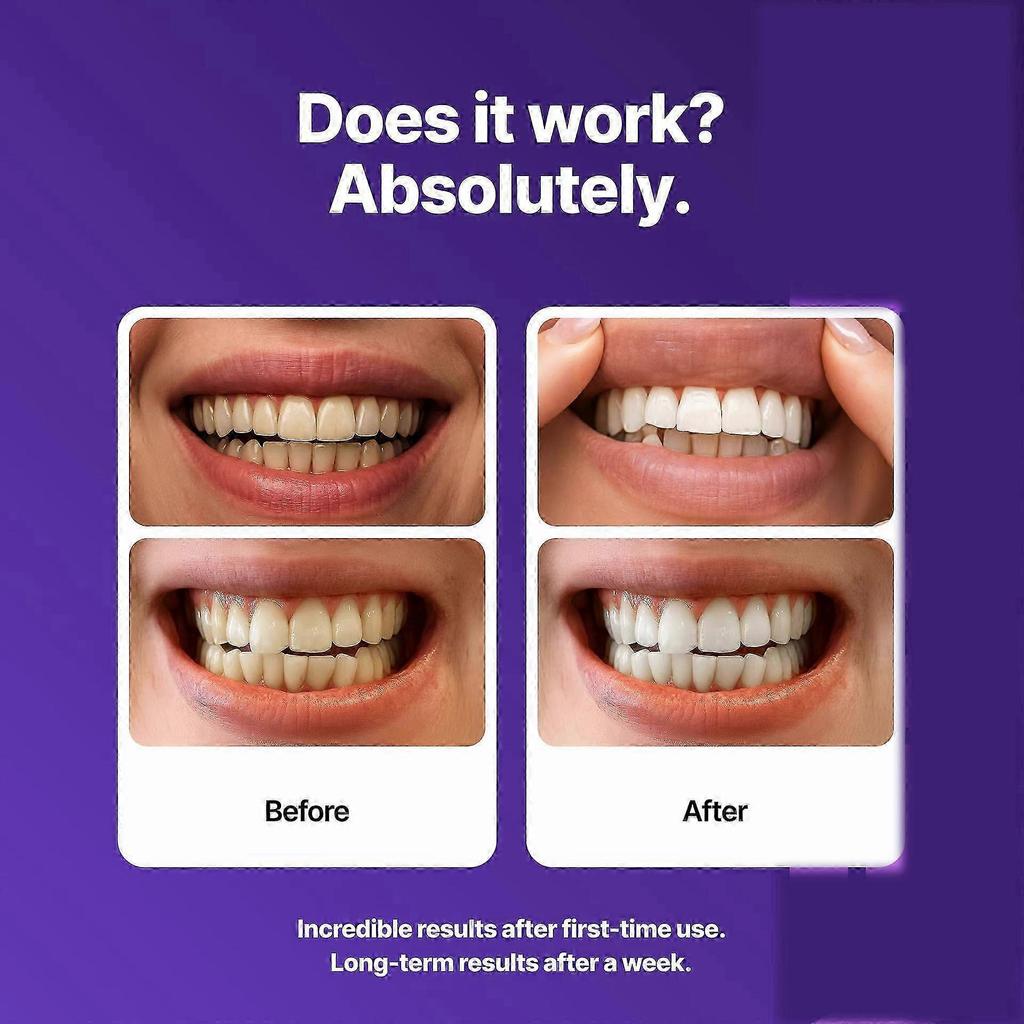 Strisce Sbiancanti Denti Viola Formula Delicata Per Uso Quotidiano Sicuro per lo Smalto Effetto Sbiancante Istantaneo Per Denti Sensibili