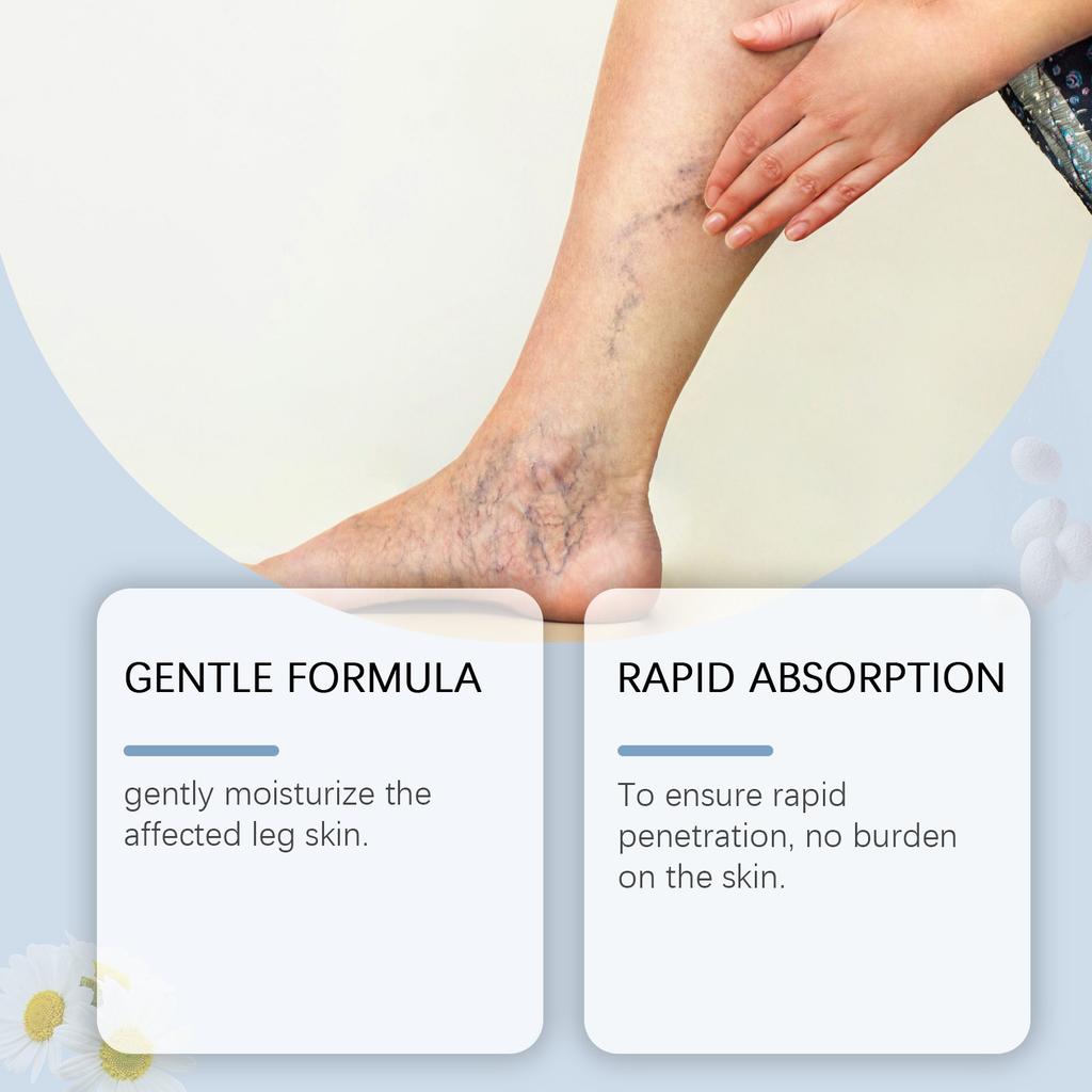 A Varicose Veins To Soothe The Leg, A Quick Leg Spray30ml