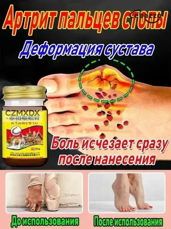 hip ointment 50 g