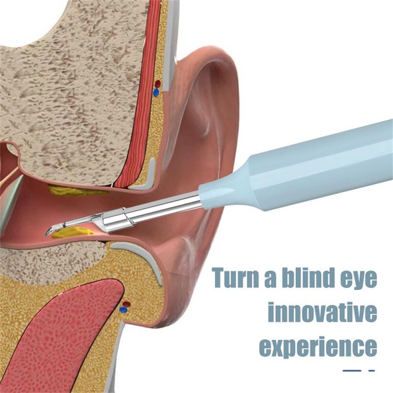 Z10 Wifi Smart Visual Ear  Sticks 4.3mm Endoscope High-definition Earpick Ear Cleaner Luminous