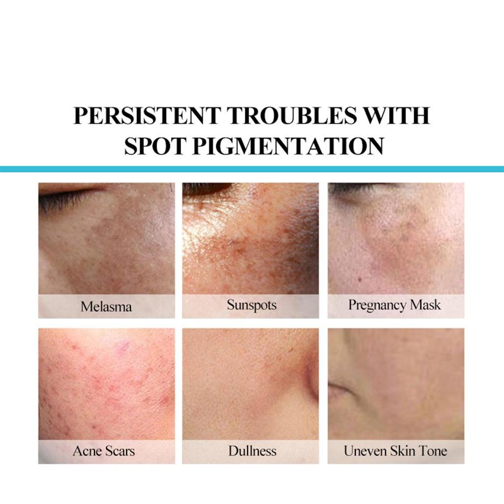 TRSTAY Moisturizing Cream, Vitamin C Brightening Face Cream, Brightening Skin And Lightening Spots