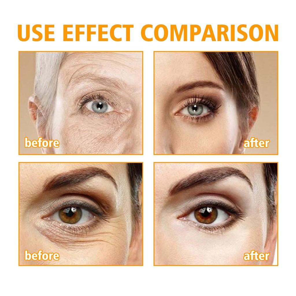 Hoygi 5d Peptide Anti-wrinkle Eye Repair Cream For Smooth And Hydrated Skin