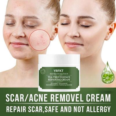 Crème anti-acné blanchissante, estompe les taches, dissolvant de cicatrices d'acné, crème de réparation de boutons, rétrécissement des pores, soins de la peau