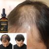 Hair Growth Serum Hair Care Product Hair Serum Fast Hair