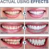 Sp-6 Probiotic Toothpaste, Sp-6 Ultra Toothpaste For Teeth Whitening, And Gum Health, Fluoride-free Mint Flavor 2PCS