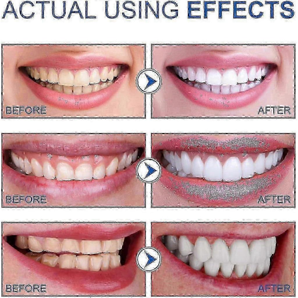 Sp-6 Probiotic Toothpaste, Sp-6 Ultra Toothpaste For Teeth Whitening, And Gum Health, Fluoride-free Mint Flavor 2PCS
