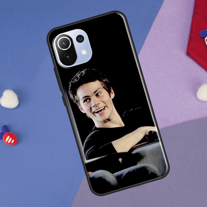 Dylan O'Brien Teen Wolf Cover For Xiaomi 14 Ultra 13 11T 12T 13T 14T Pro POCO X6 X7 Pro X3 X5 F3 F5 F6 M6 Pro Case