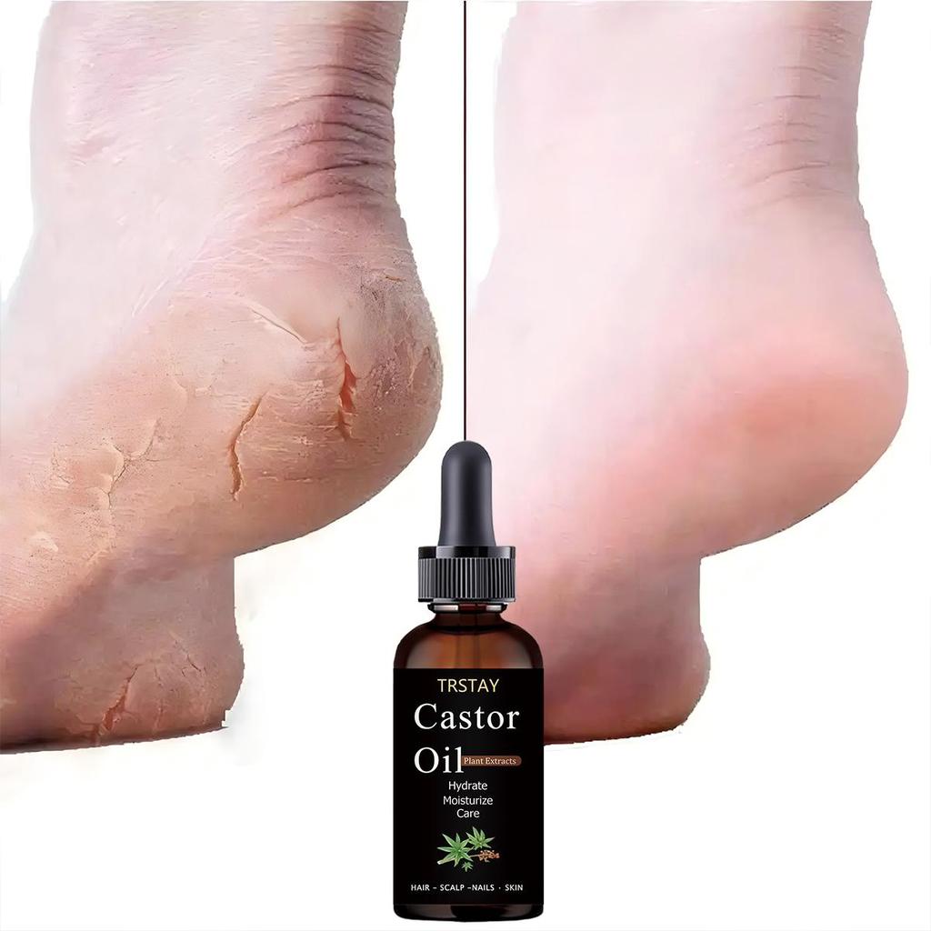 Foot Cracking, with Slight Relief and Flexibility, Refreshing and Comfortable