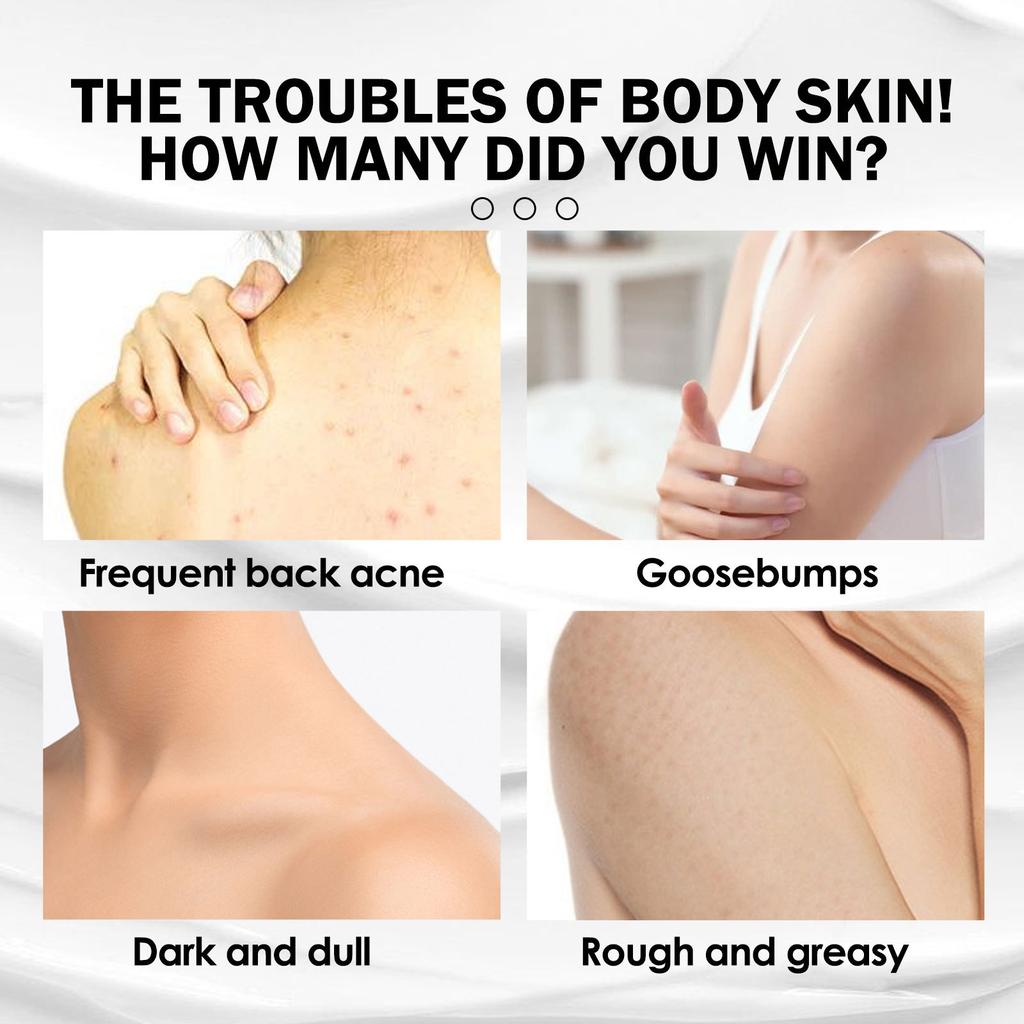 Loção Corporal Ultra Hidratante para Pele Suave e Radiante, Reparação e Clareamento da Pele de Frango