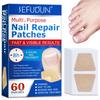 Nail Correction Stickers Ingrown Toenail Corrector Patches Renewal PlasterTreatment Recover Corrector Pedicure Care Tool