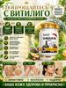 Anti Vitiligo Cream Treatment 50 G