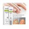 3x Efero Nagelpeeling Pflanzen-Nagelreparatur-Flüssigkeit Nagelcreme Nagelpflege-Gel Nagelreparatur-Gel Feuchtigkeitsspendender Nagelglanz Tw