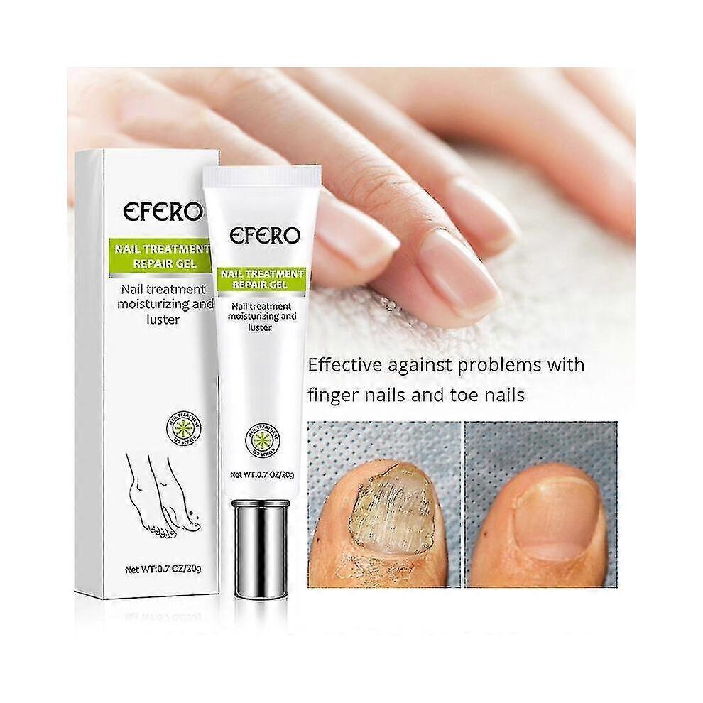 3x Efero Nagelpeeling Pflanzen-Nagelreparatur-Flüssigkeit Nagelcreme Nagelpflege-Gel Nagelreparatur-Gel Feuchtigkeitsspendender Nagelglanz Tw