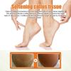 South Moon Foot Exfoliating Spray Moisturizing Dead Skin Removal Hydrating