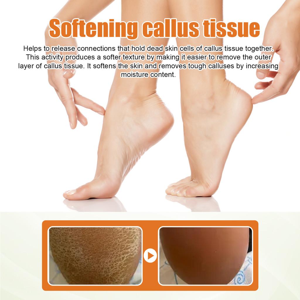 South Moon Foot Exfoliating Spray Moisturizing Dead Skin Removal Hydrating