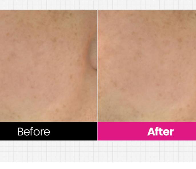 TOSOWOONG Arbutin 5% Whitening Cream 50g — Brightening & Moisturizing Care for Pigmentation and Wrinkles