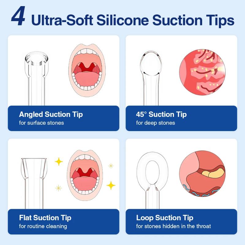 Electric Tonsil Stone Removal Kit 3 Suction Levels Vacuum Oral Care Set Fight Bad Breath Perfect for Home Travel Use