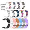 Acessórios para eletrónicos inteligentes – Braceletas de relógios inteligentes