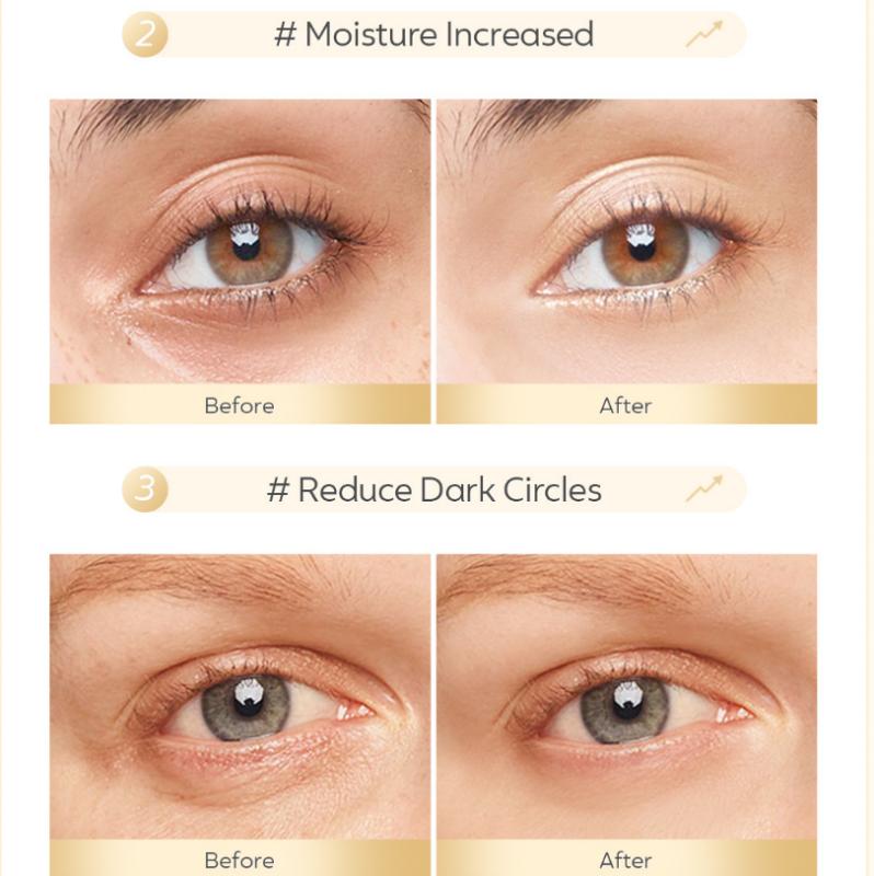 50PCS Masque Yeux Hydratant Or Hydratant Masque Yeux Hydratant Atténuation des Cernes Patchs Yeux Poches Sous les Yeux Raffermissement Patch