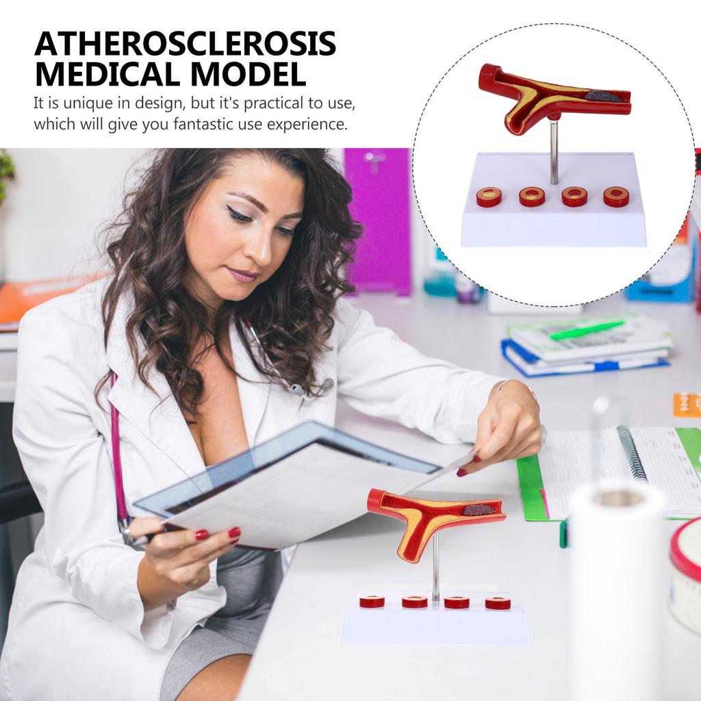 Pvc Cardiovascular Model Science Atherosclerosis Display Hospital Teaching Supplies Anatomical Models Physiology